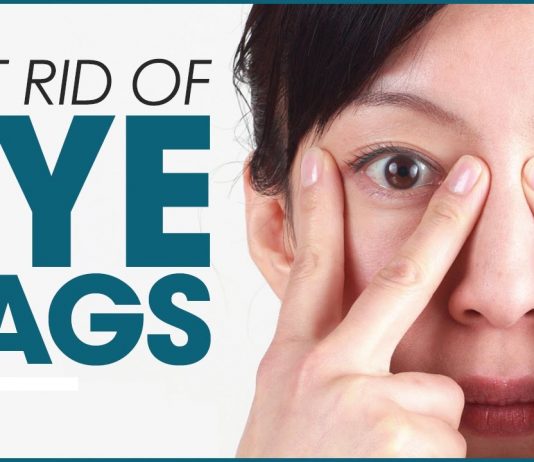 How to Minimize Under-Eye Bags
